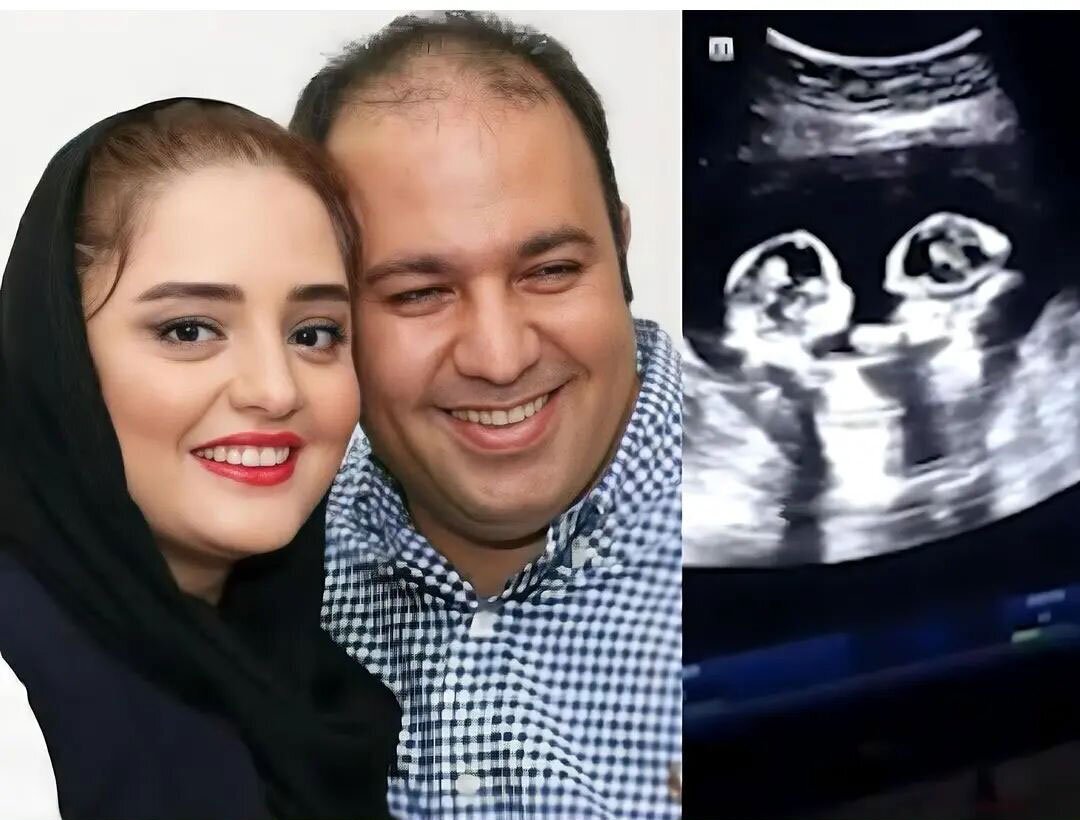 عکس | چه اتفاقی برای این زوج معروف سینما افتاده است؟! عکس | چه اتفاقی برای این زوج معروف سینما افتاده است؟!