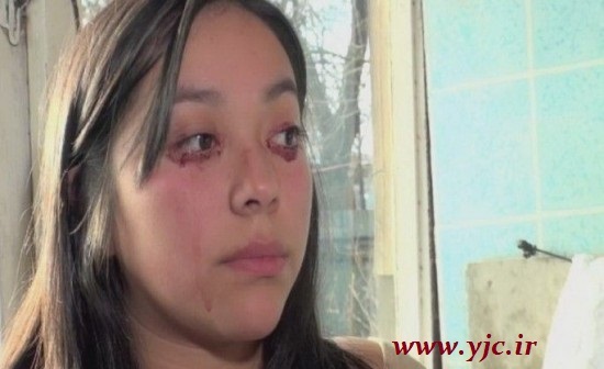 عکس | تصویری عجیب اما واقعی از دختری که خون گریه میکند! عکس | تصویری عجیب اما واقعی از دختری که خون گریه میکند!