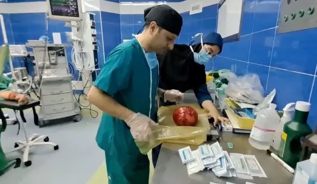 عکس | تومور ۱۱ کیلویی از شکم یک زن خارج شد! عکس | تومور ۱۱ کیلویی از شکم یک زن خارج شد!