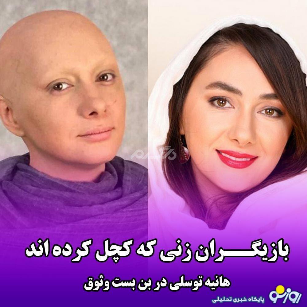 عکس | کدام بازیگران زن خود را کچل کرده‌اند؟!