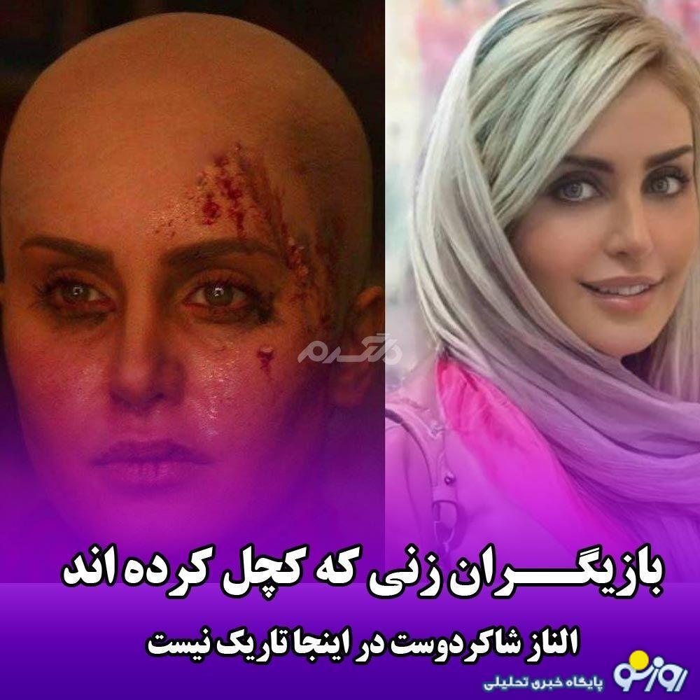 عکس | کدام بازیگران زن خود را کچل کرده‌اند؟!