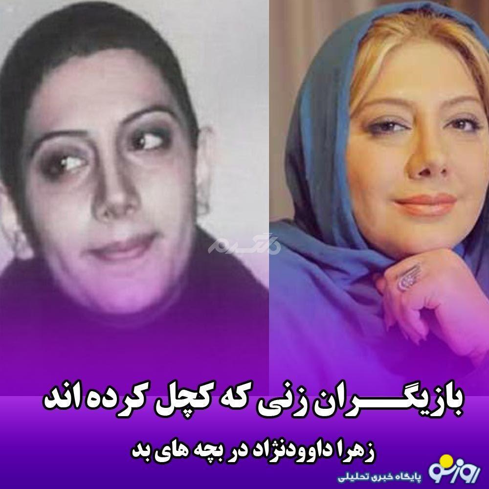 عکس | کدام بازیگران زن خود را کچل کرده‌اند؟!