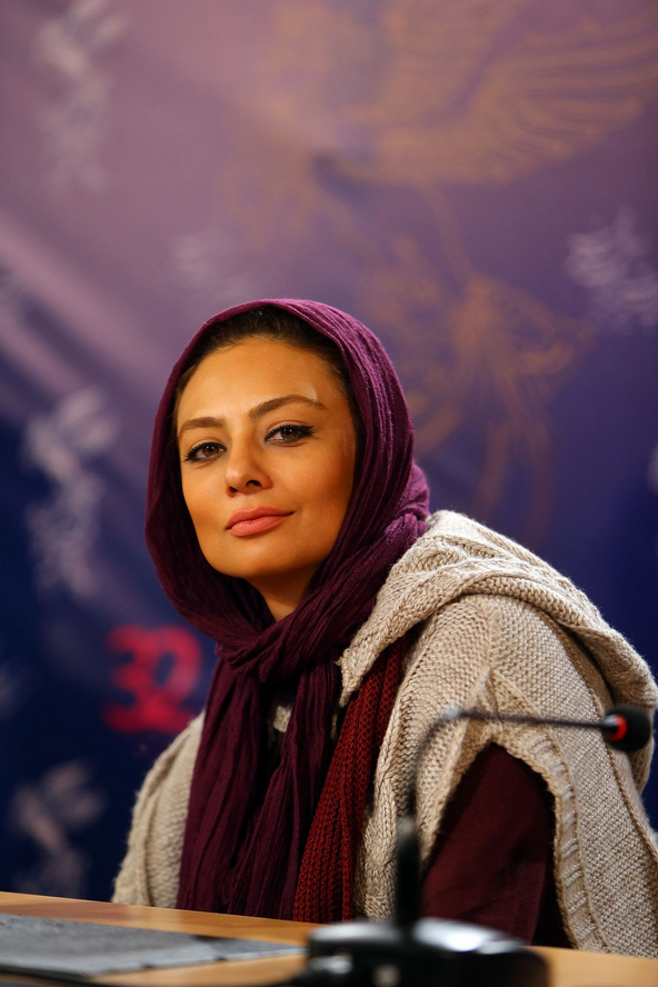 عکس | چهره یکتا ناصر بعد از عمل زیبایی زیر و رو شد! عکس | چهره یکتا ناصر بعد از عمل زیبایی زیر و رو شد!