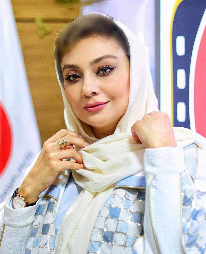 عکس | چهره یکتا ناصر بعد از عمل زیبایی زیر و رو شد! عکس | چهره یکتا ناصر بعد از عمل زیبایی زیر و رو شد!