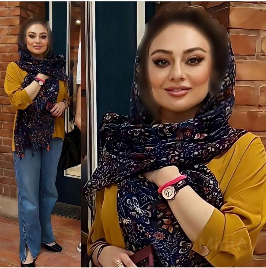 عکس | چهره یکتا ناصر بعد از عمل زیبایی زیر و رو شد! عکس | چهره یکتا ناصر بعد از عمل زیبایی زیر و رو شد!