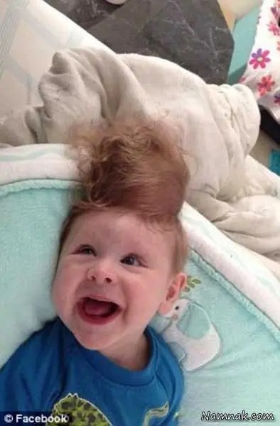 عکس | نوزادی که مغزش بیرون از سرش بود عمل شد! عکس | نوزادی که مغزش بیرون از سرش بود عمل شد!