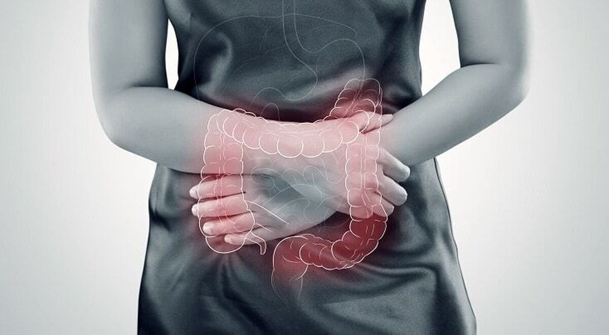 حفظ سلامت روده با کاهش مصرف این خوراکی‌ها