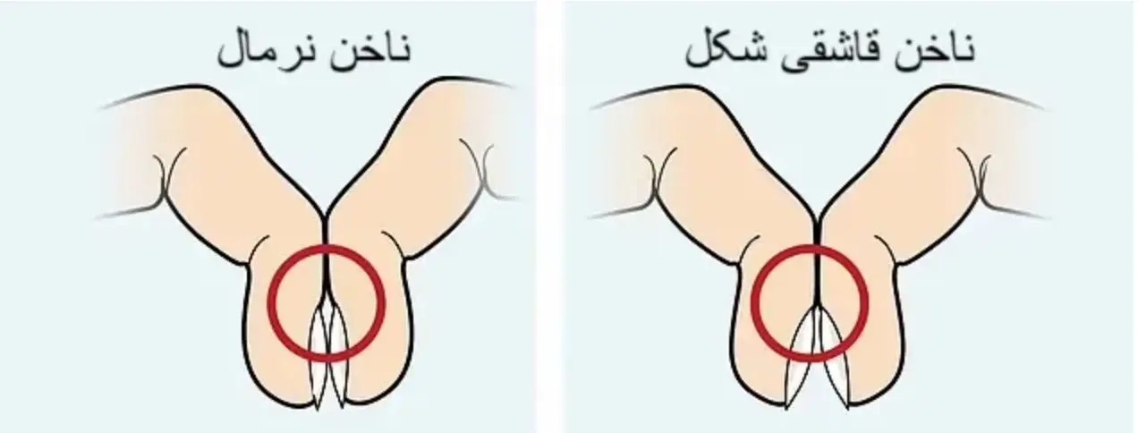 با این تست ۵ ثانیهای سرطان ریه را تشخیص بدهید! با این تست ۵ ثانیهای سرطان ریه را تشخیص بدهید!