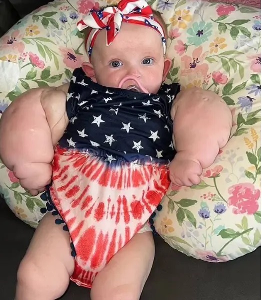 عکس | با دیدن این نوزاد وحشت خواهید کرد! عکس | با دیدن این نوزاد وحشت خواهید کرد!