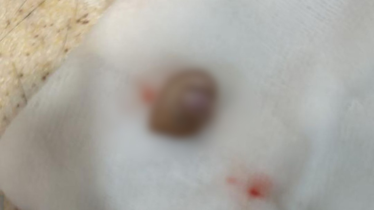 عکس | نقاله مکانیکی فرودگاه انگشت اشاره دختر ۴ ساله را قطع کرد!