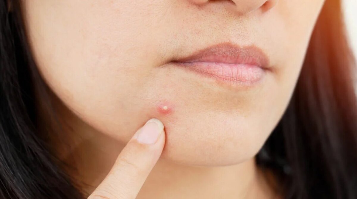 این ناحیه در صورت به «مثلث مرگ» معروف است!