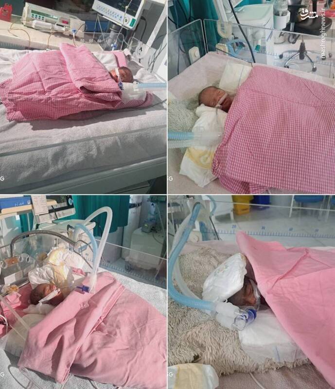 عکس | زن یاسوجی در اولین زایمانش ۴ قلو به دنیا آورد!