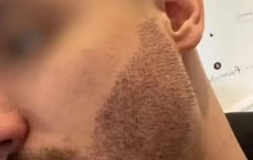 خودکشی پسر جوان به دلیل کاشت ریشی که خوب از آب درنیامد! خودکشی پسر جوان به دلیل کاشت ریشی که خوب از آب درنیامد!