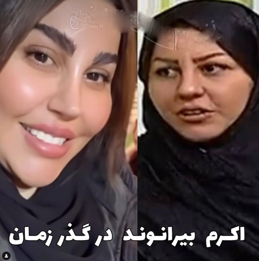 عکس | همسر بیرانوند در گذر زمان! | این تغییرات چهره کار چند عمل زیبایی است؟!