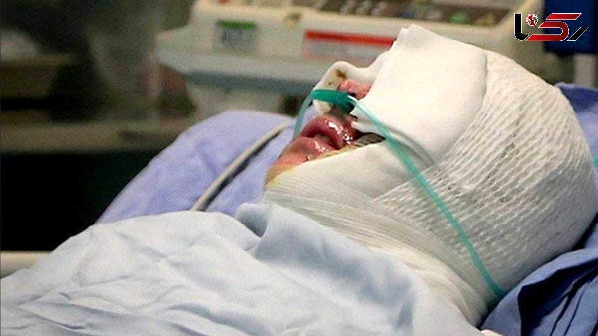 ماجرای اسیدپاشی روی صورت ناظم مدرسه در کرج!