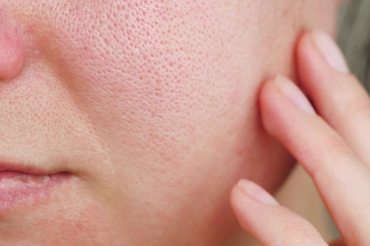 چگونه پوستی صاف و بدون منافذ داشته باشیم؟ 5 نکته طلایی مراقبت از پوست