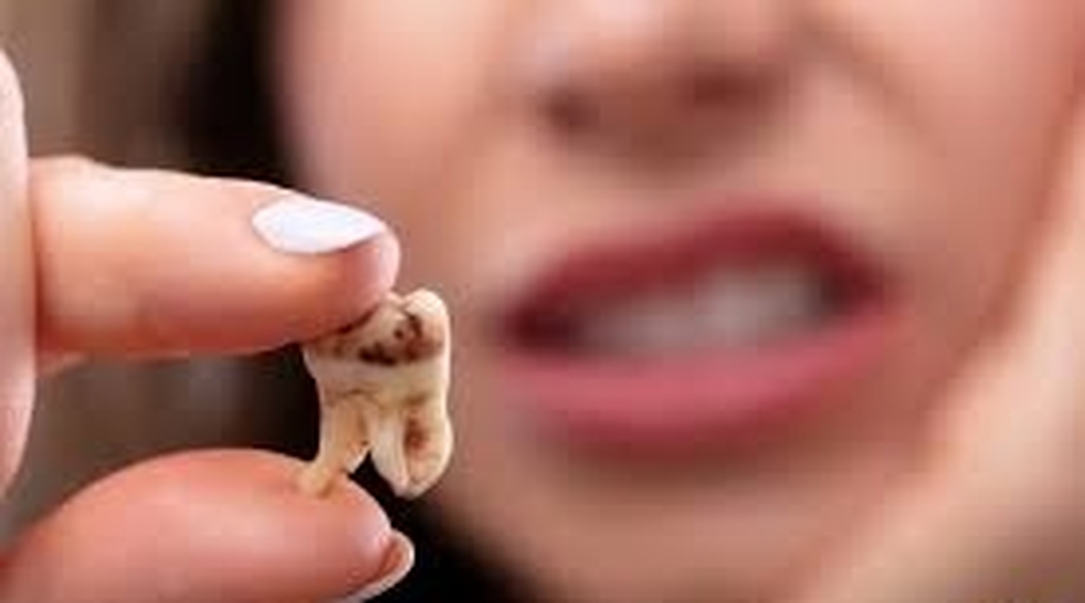 ۹ اشتباه در مراقبت از بهداشت دهان و دندان