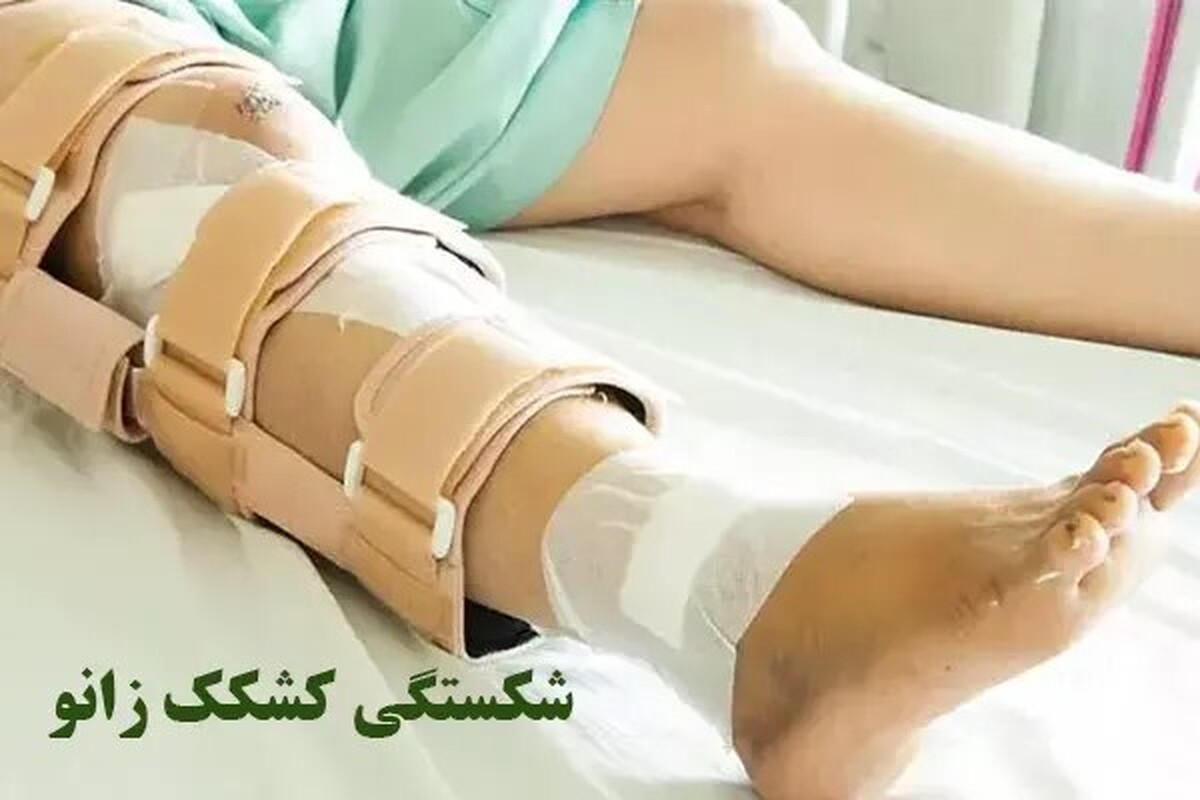 سلامت زانو از آسیب حاد تا آرتروز | نقش جراح ارتوپد در درمان شکستگی و تعویض مفصل