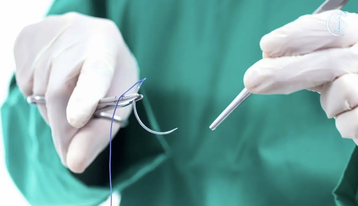 شناسایی و‌ دستگیری پزشک قلابی سیار در حین انجام عمل زیبایی